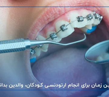 بهترین زمان برای انجام ارتودنسی کودکان، والدین بدانند!