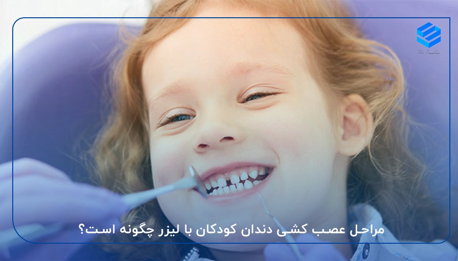مراحل عصب کشی دندان کودکان با لیزر چگونه است؟