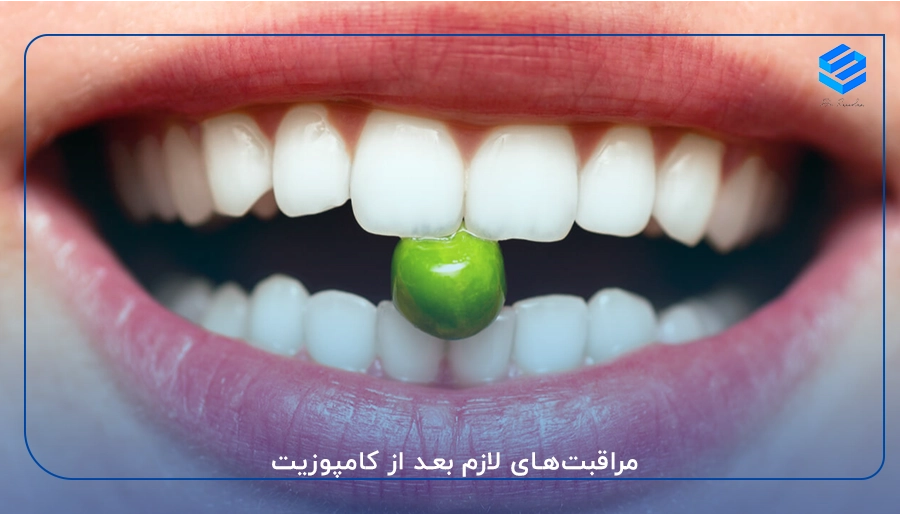 مراقبت‌های لازم بعد از کامپوزیت