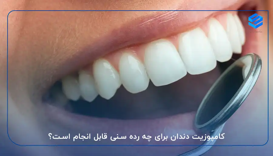 سن مناسب برای کامپوزیت دندان