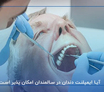 آیا ایمپلنت دندان در سالمندان امکان پذیر است؟