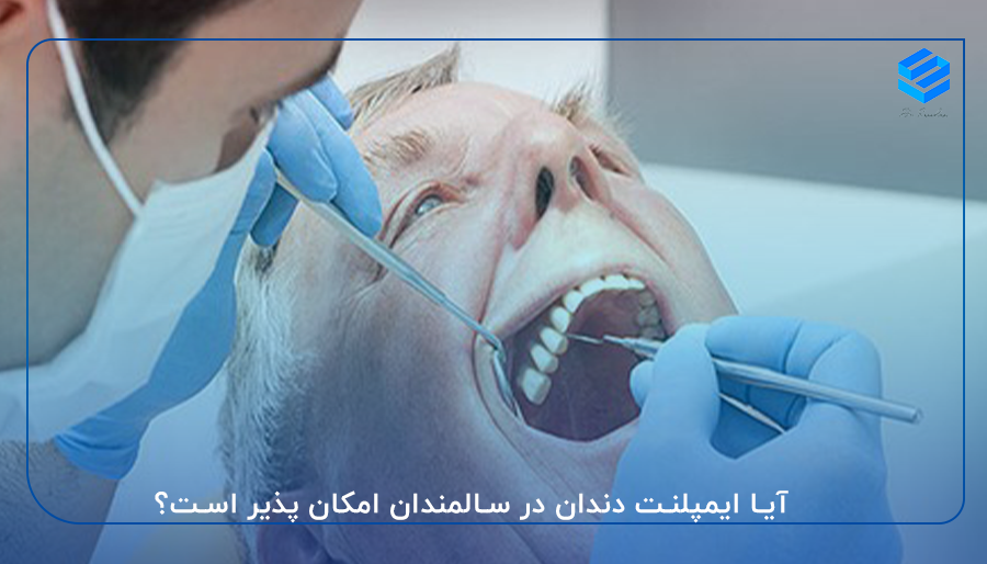 آیا ایمپلنت دندان در سالمندان امکان پذیر است؟