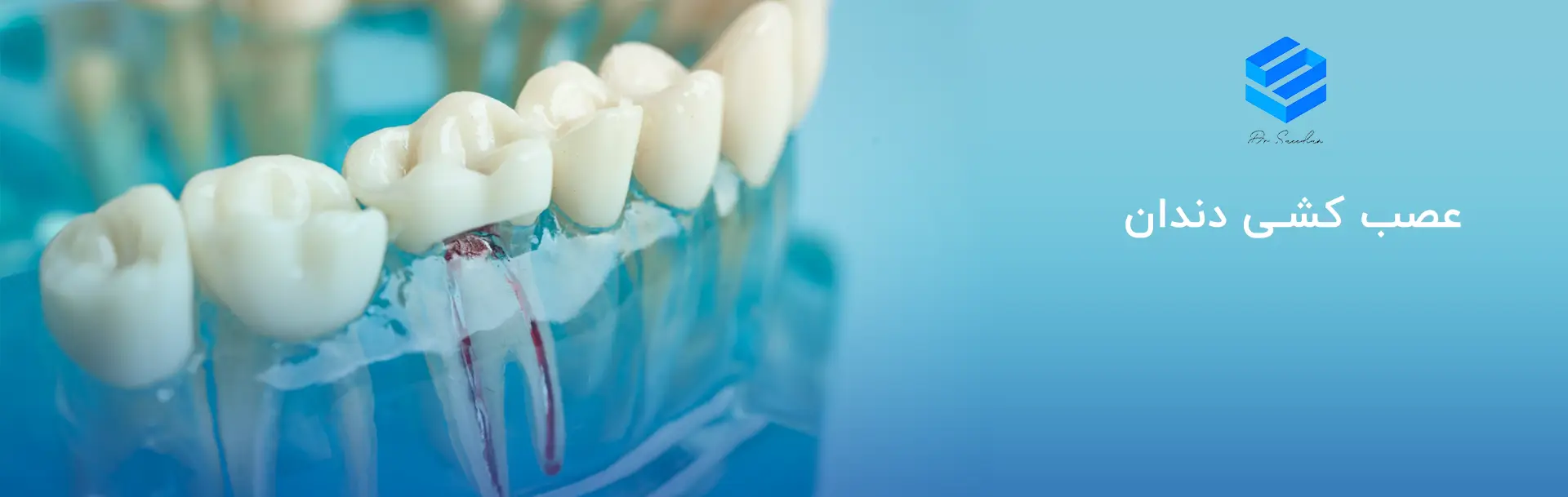 عصب کشی دندان چیست؟