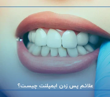 علائم پس زدن ایمپلنت چیست؟