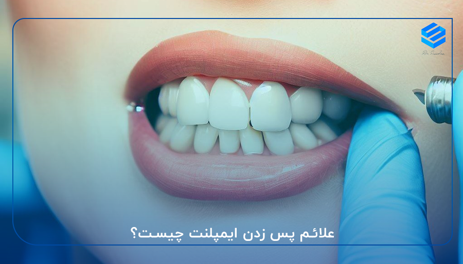 علائم پس زدن ایمپلنت چیست؟