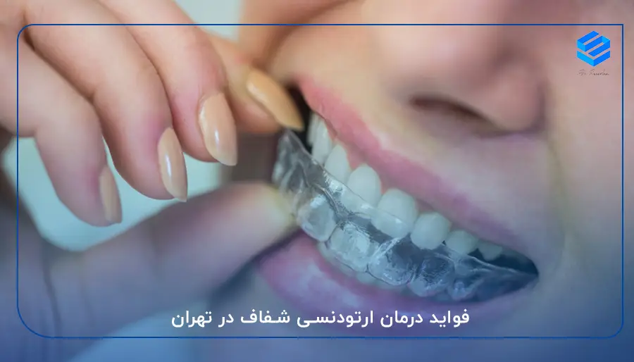 فواید درمان ارتودنسی شفاف در تهران