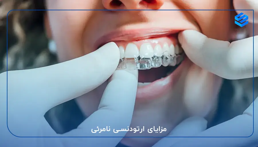 مزایای ارتودنسی نامرئی