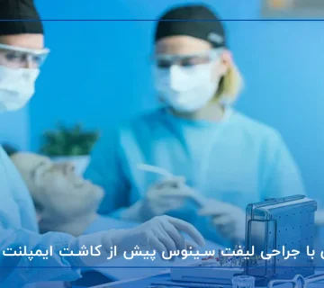 آشنایی با جراحی لیفت سینوس پیش از کاشت ایمپلنت دندان