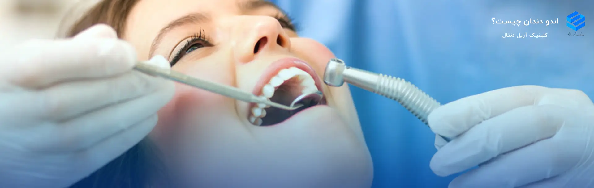 اندو دندان چیست؟