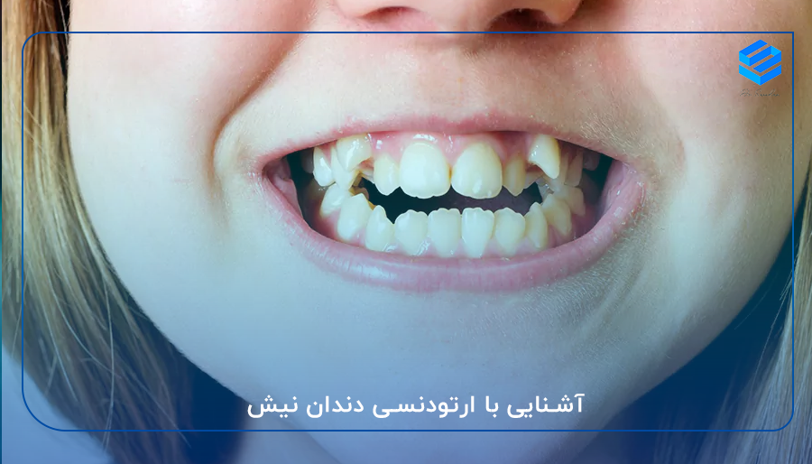 آشنایی با ارتودنسی دندان نیش