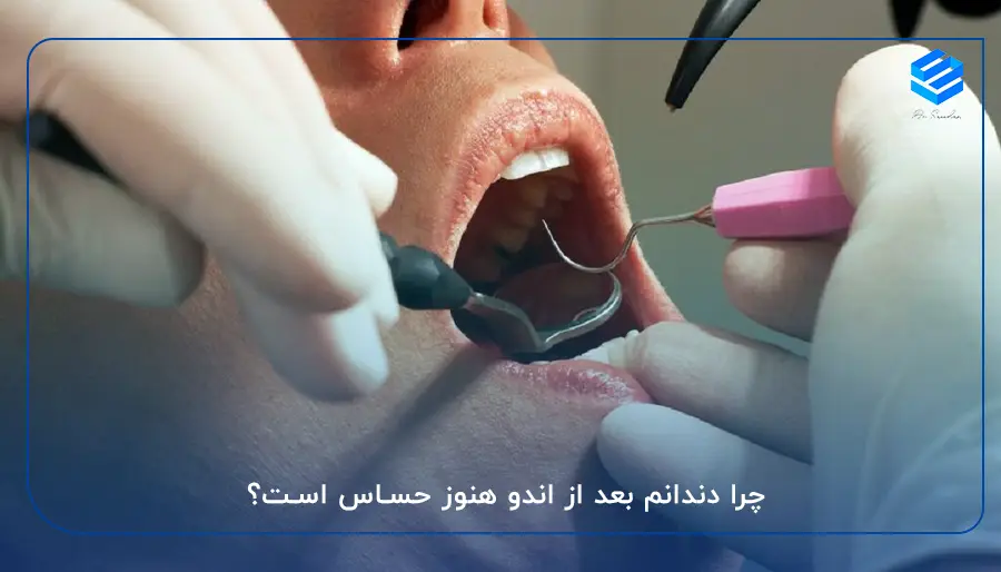 چرا دندانم بعد از اندو هنوز حساس است؟