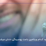 کمبود کدام ویتامین باعث پوسیدگی دندان میشود؟